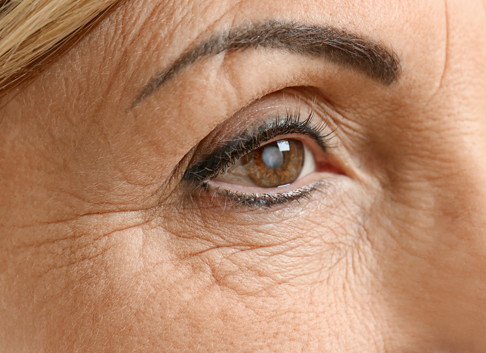 How Do You Know If You Have Cataracts?