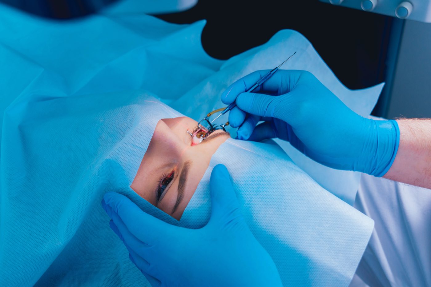 How are cataracts removed?