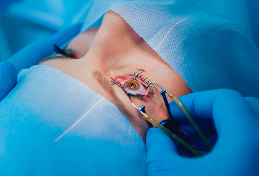 3 Ways to Choose the Best Eye Specialist for Cataract Surgery