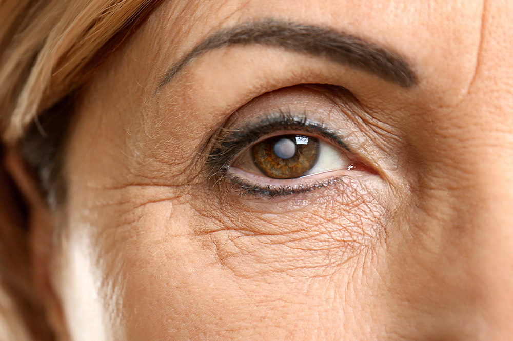 Almost All Risks From Cataract Surgery Are Avoidable!