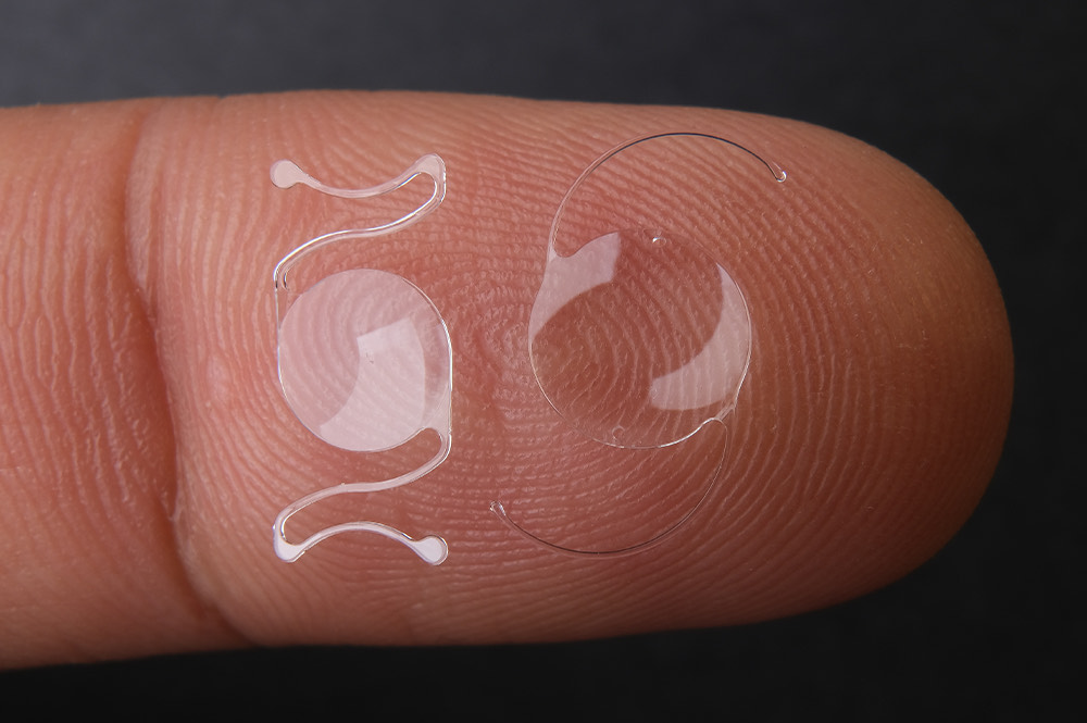 Symptoms of Dislocated Lens After Cataract Surgery