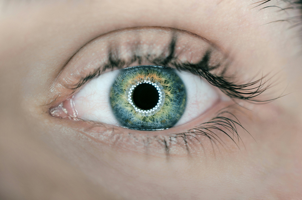 Pros and Cons of Light Adjustable Lenses