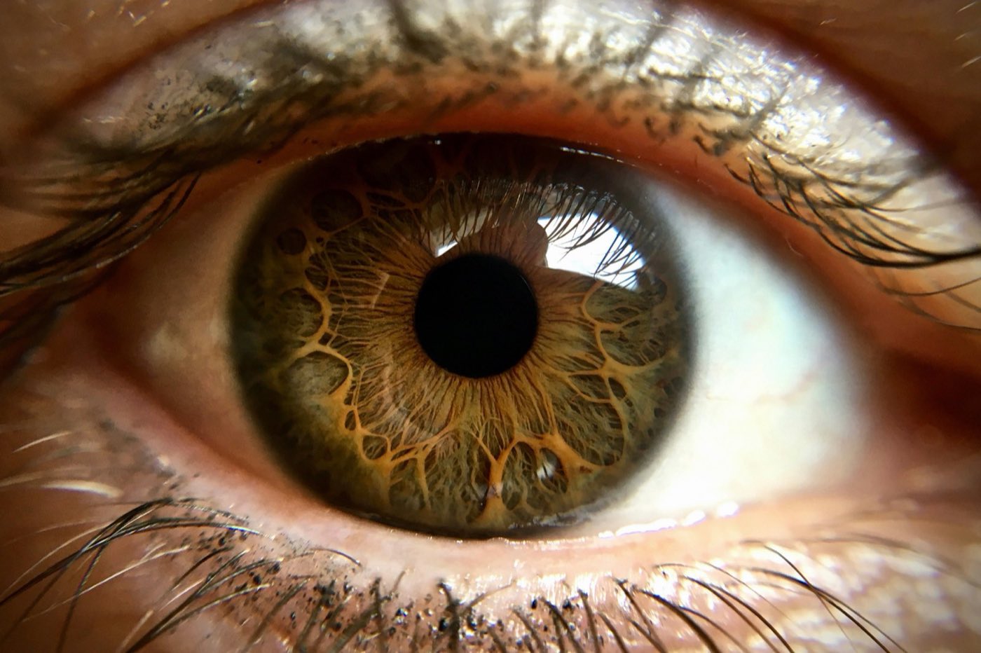 Is Premium Cataract Surgery Worth It? Understanding Advanced Lens Options