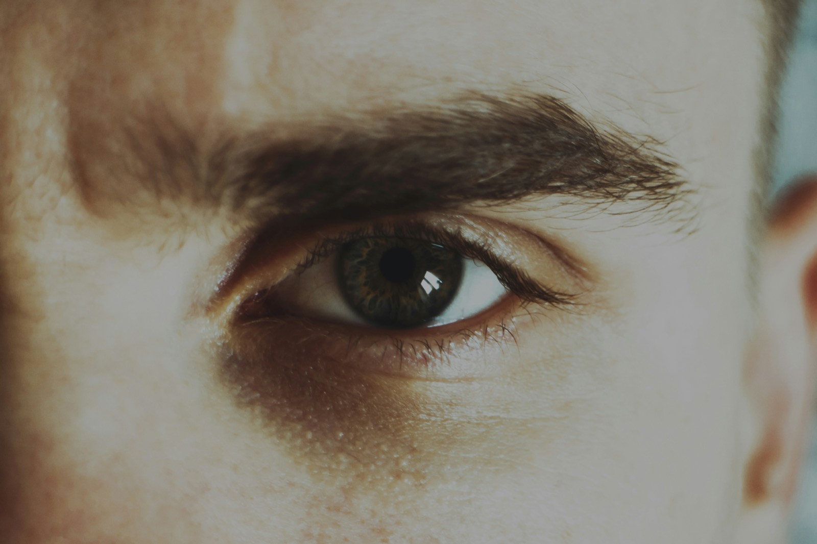 Cataracts in Younger Adults: Causes and Treatment Options