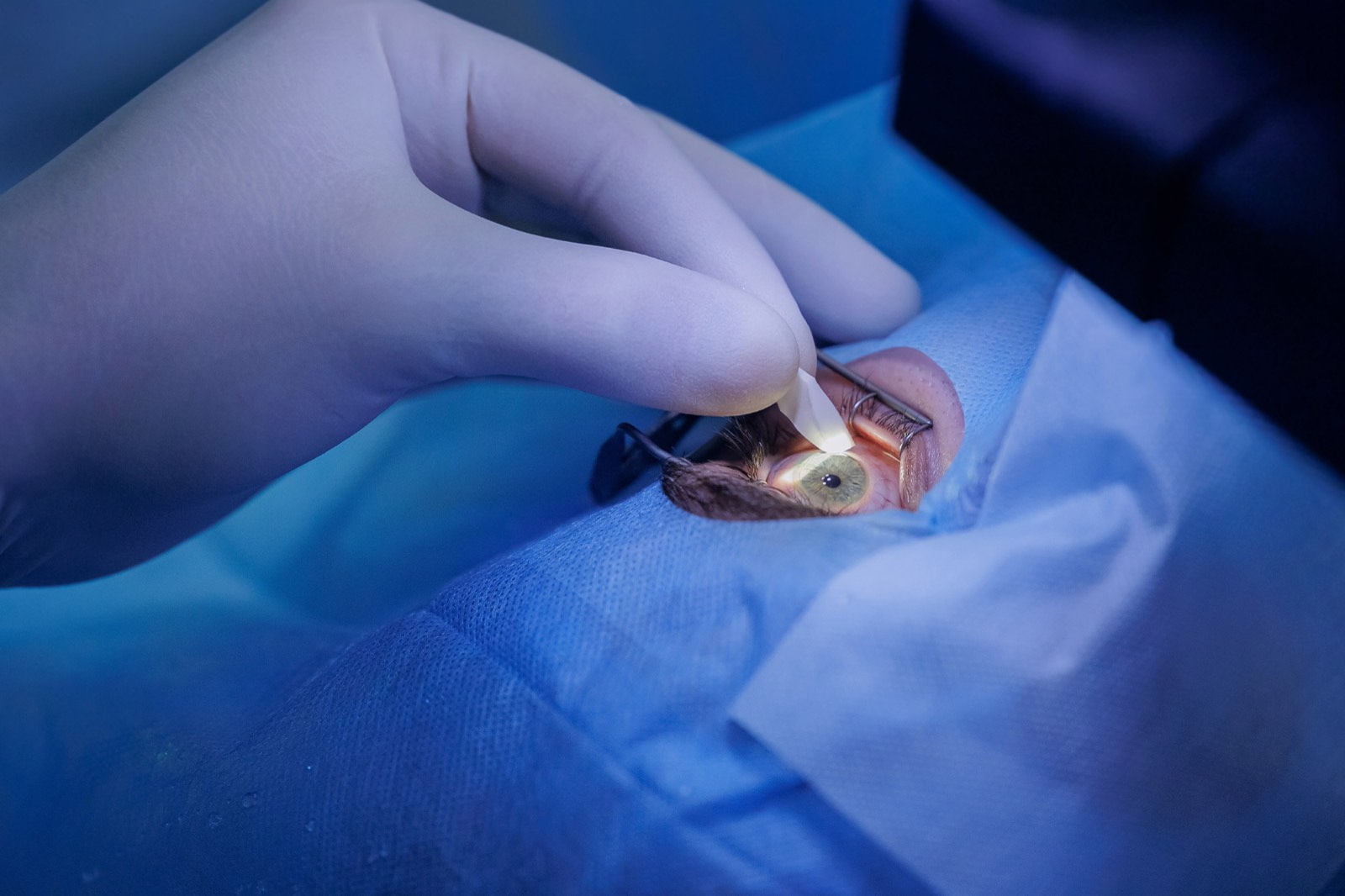 Why Early Detection of Cataracts Leads to Better Outcomes