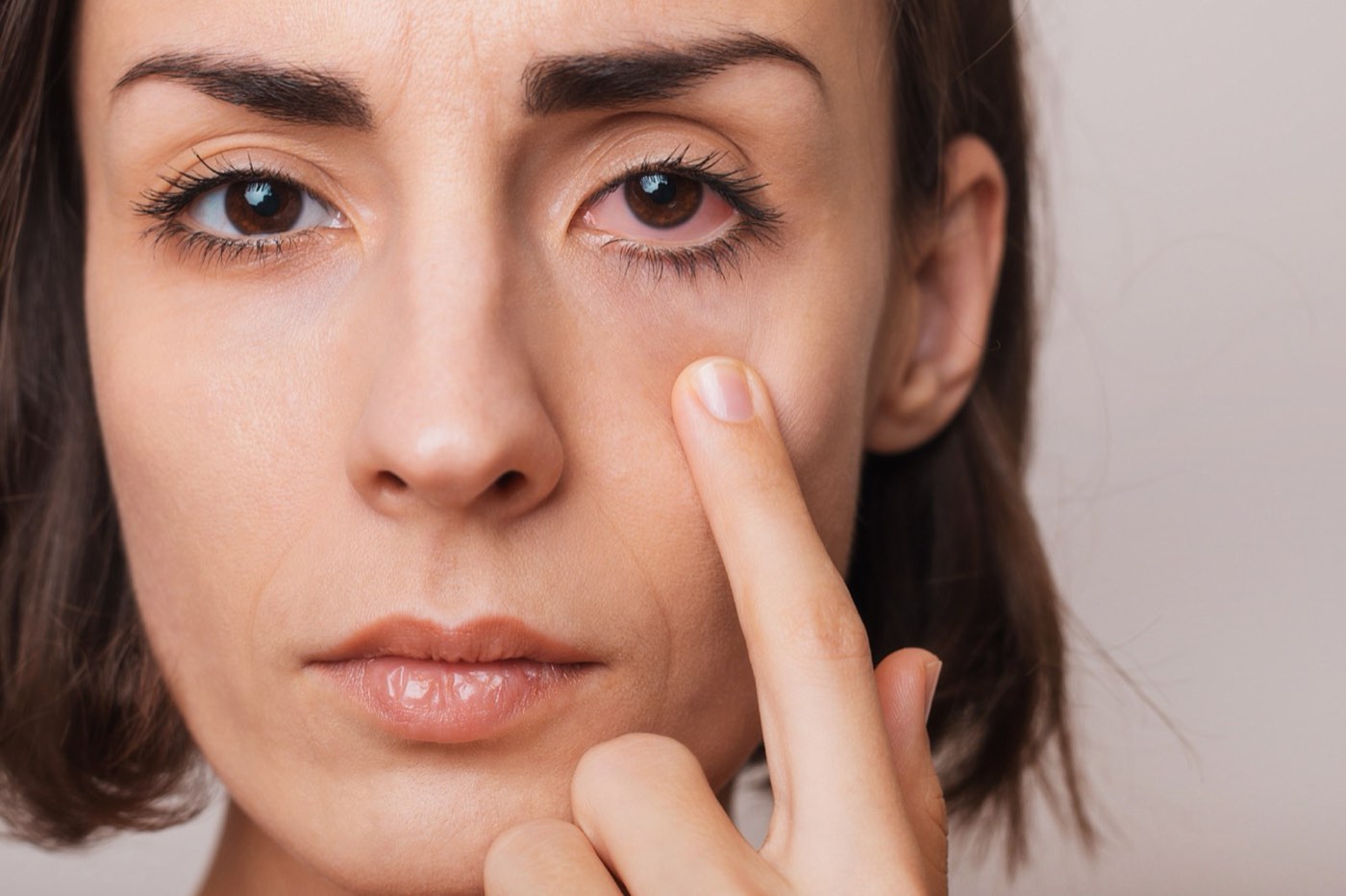 Dry Eye Syndrome in Boca Raton: Causes and Long-Term Relief