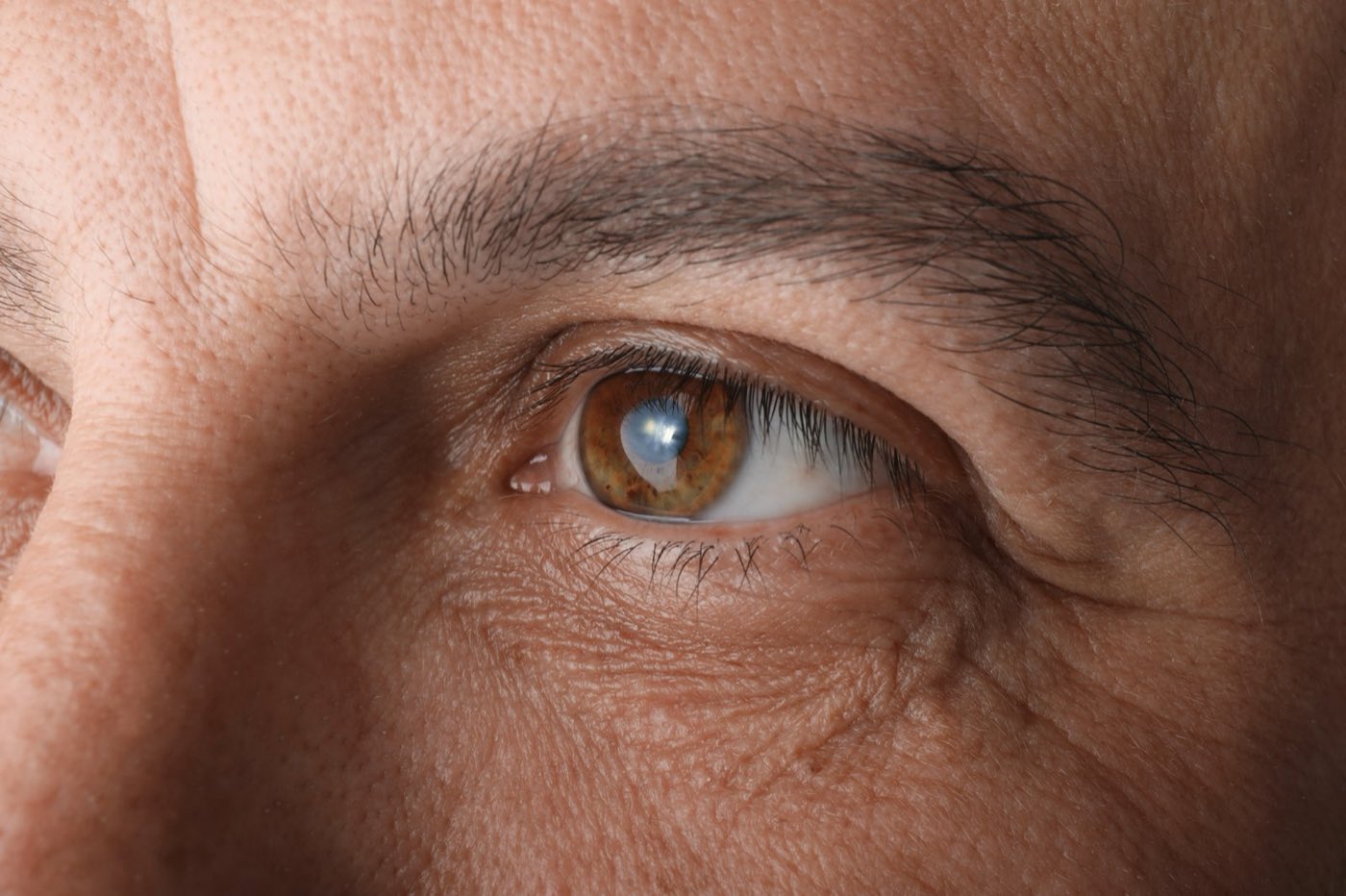 What to Expect 6 Months After Cataract Surgery